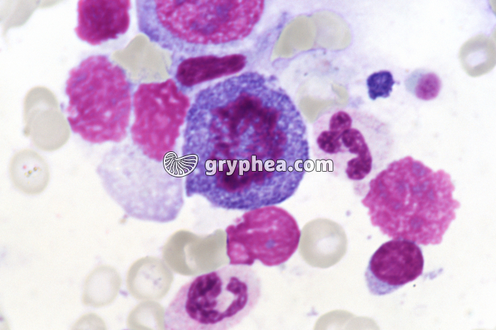Moelle osseuse humaine cellules en mitose - prophase x400 - gryphea.com